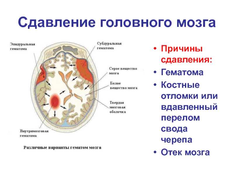 Причины гематомы в ухе у собаки и лечение в домашних условиях (гематома ушной раковины)
