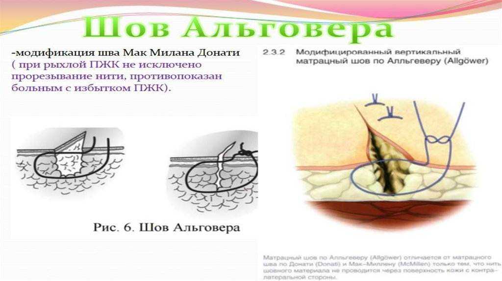 Методы наложения шва после стерилизации кошки и способы ухода в послеоперационный период