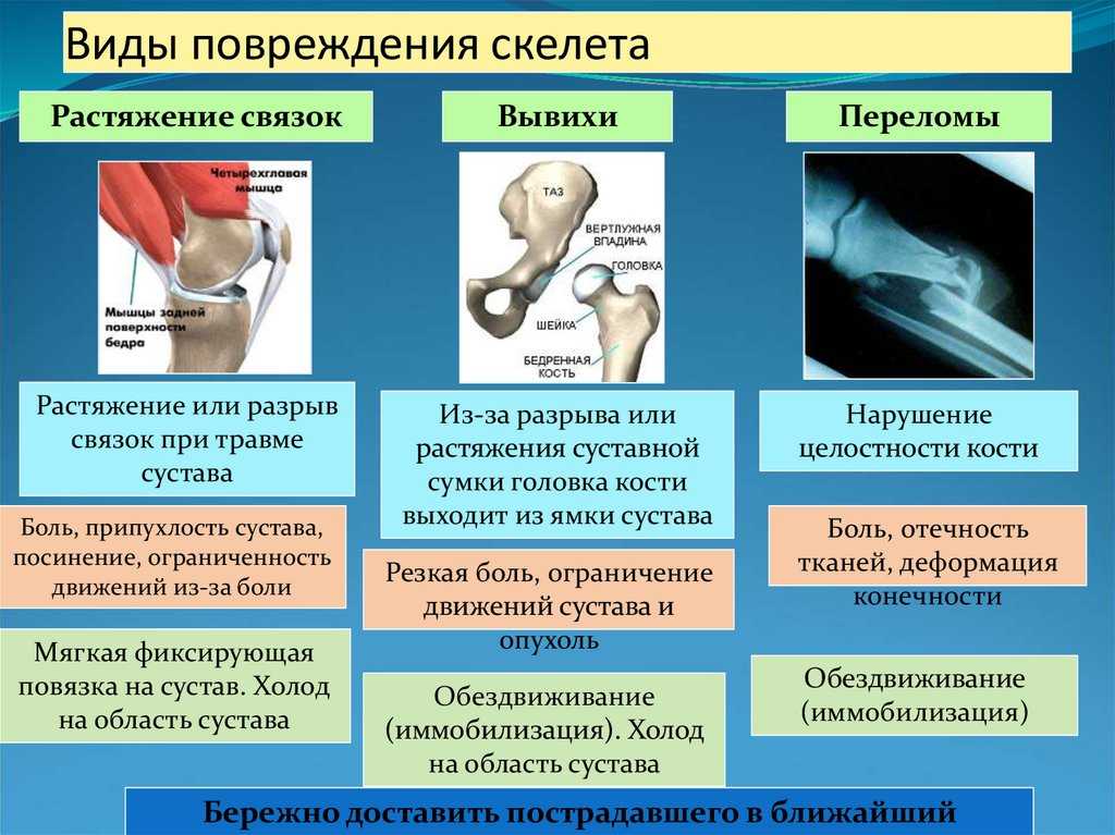 Медиальный вывих коленной чашечки у собаки, лечение | блог ветклиники "беланта"
