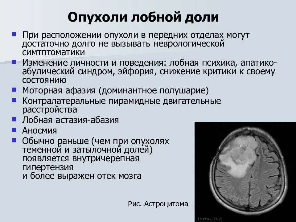 Отёк мозга у собаки. опухоль