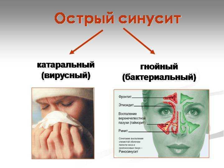 Как вылечить насморк кошке в домашних условиях?
