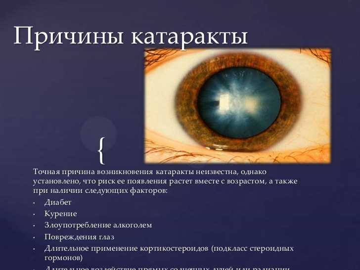 Катаракта у собак: причины, симптомы, лечение