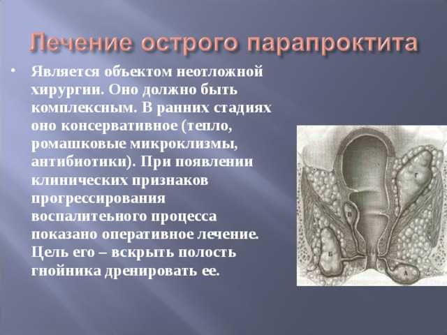 Параанальное воспаление у кошки: симптомы воспаления железы и лечение