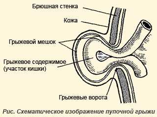 Пупочная грыжа у щенков и котят: причины, диагностика и лечение | блог ветклиники "беланта"